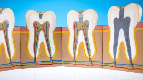 Afbeelding van cursus Endodontische diagnostiek